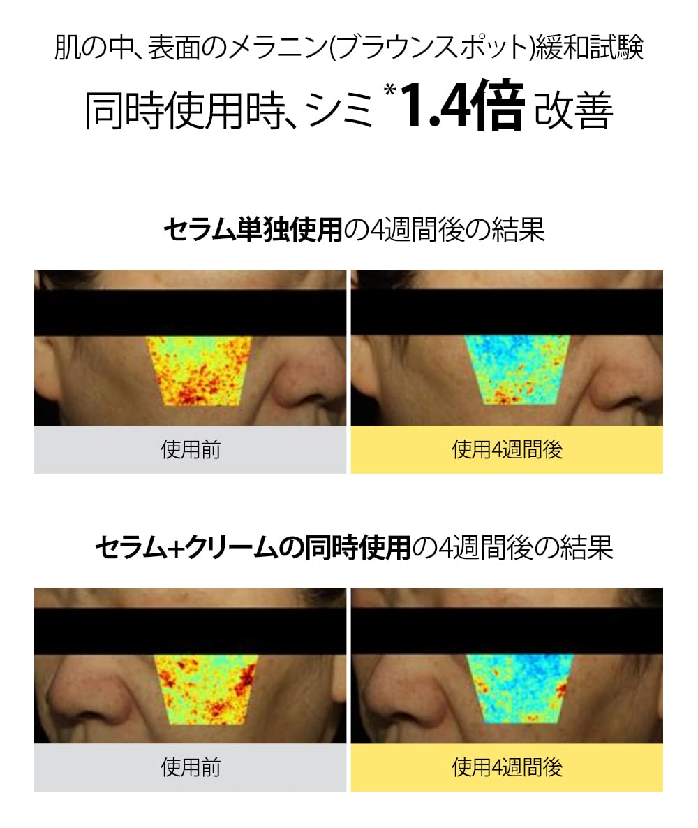 61DVb4qKlIL._SL1185_