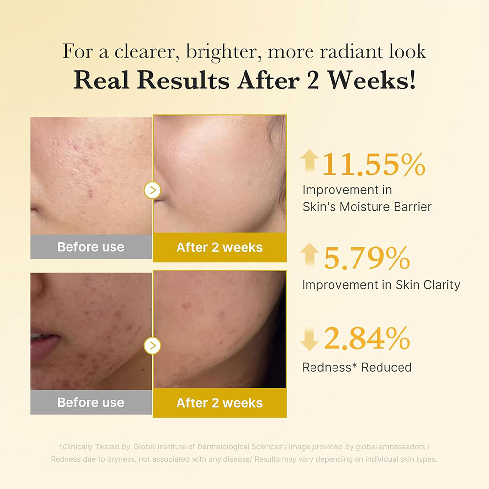 سرم-ضد-لک-و-روشن-کننده-کوجیک-اسید-و-نیاسینامید-مدی-کیوب-Medicube-Kojic-Acid-Turmeric-Niacinamide-Serum-5