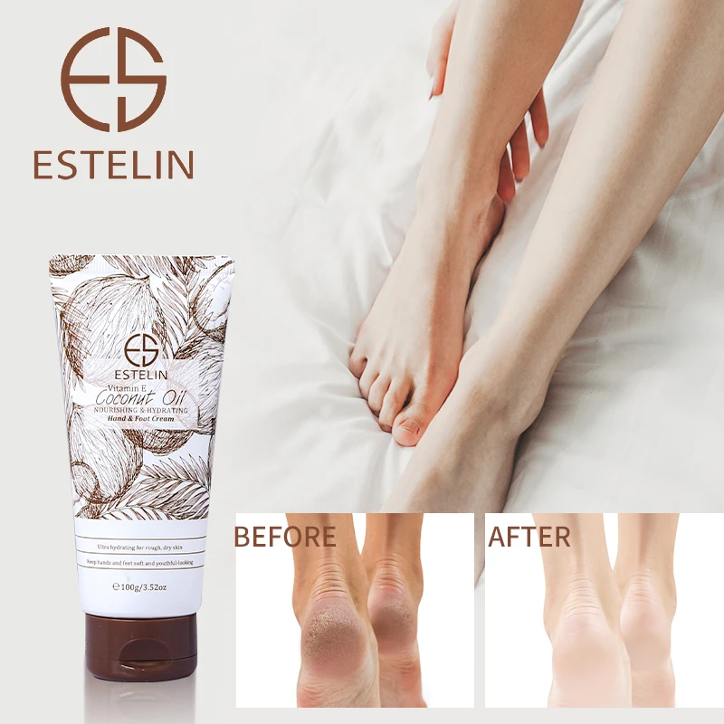 کرم-دست-و-پا-نارگیل-و-ویتامین-E-استلین-ESTELIN-Coconut-Oil-Hand-Foot-Cream-3