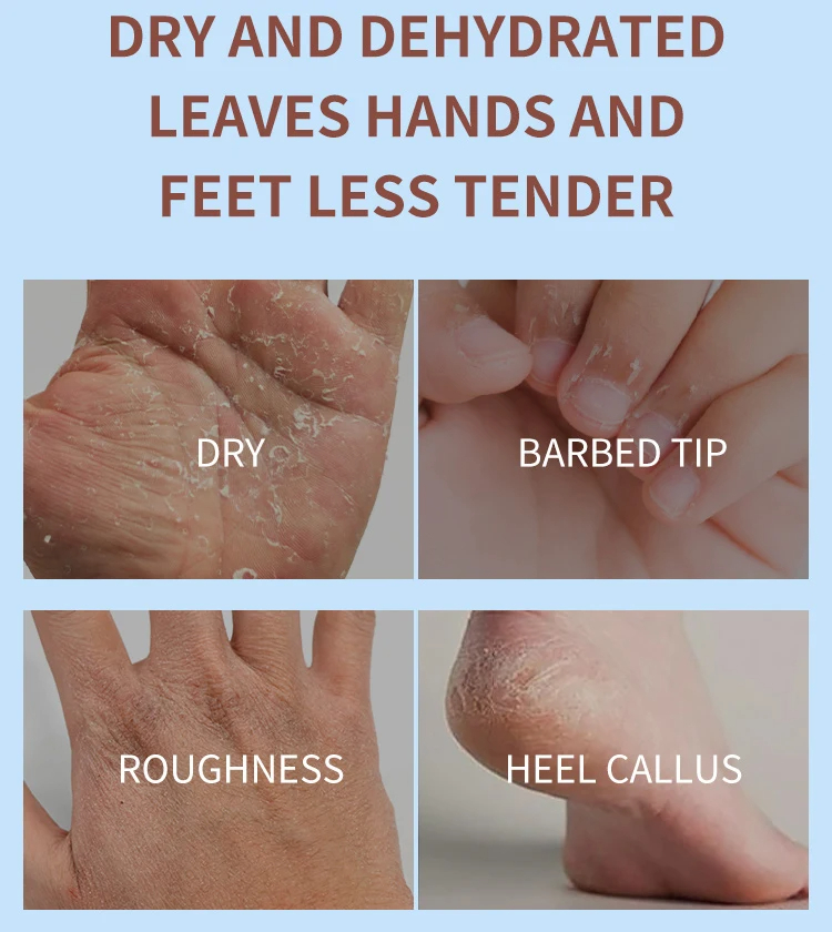 کرم-دست-و-پا-نارگیل-و-ویتامین-E-استلین-ESTELIN-Coconut-Oil-Hand-Foot-Cream-6