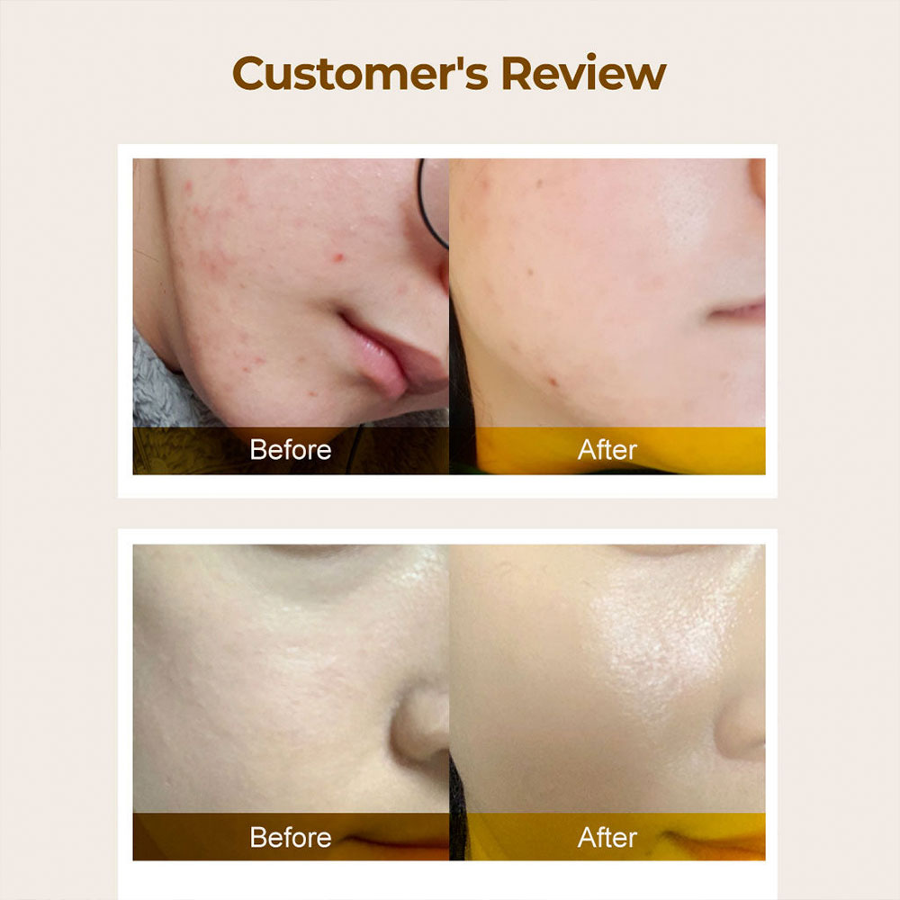 تونر-اسنس-شفاف-و-روشن-کننده-شماره-3-نامبوزین-NUMBUZIN-No.-3-Super-Glowing-Essence-Toner-10