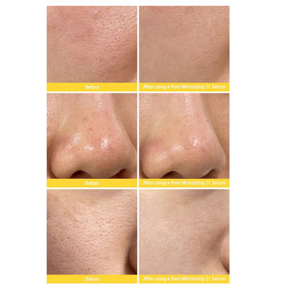 سرم-روشن-کننده-و-کنترل-منافذ-تیام-TIAM-Pore-Minimizing-21-Serum-2