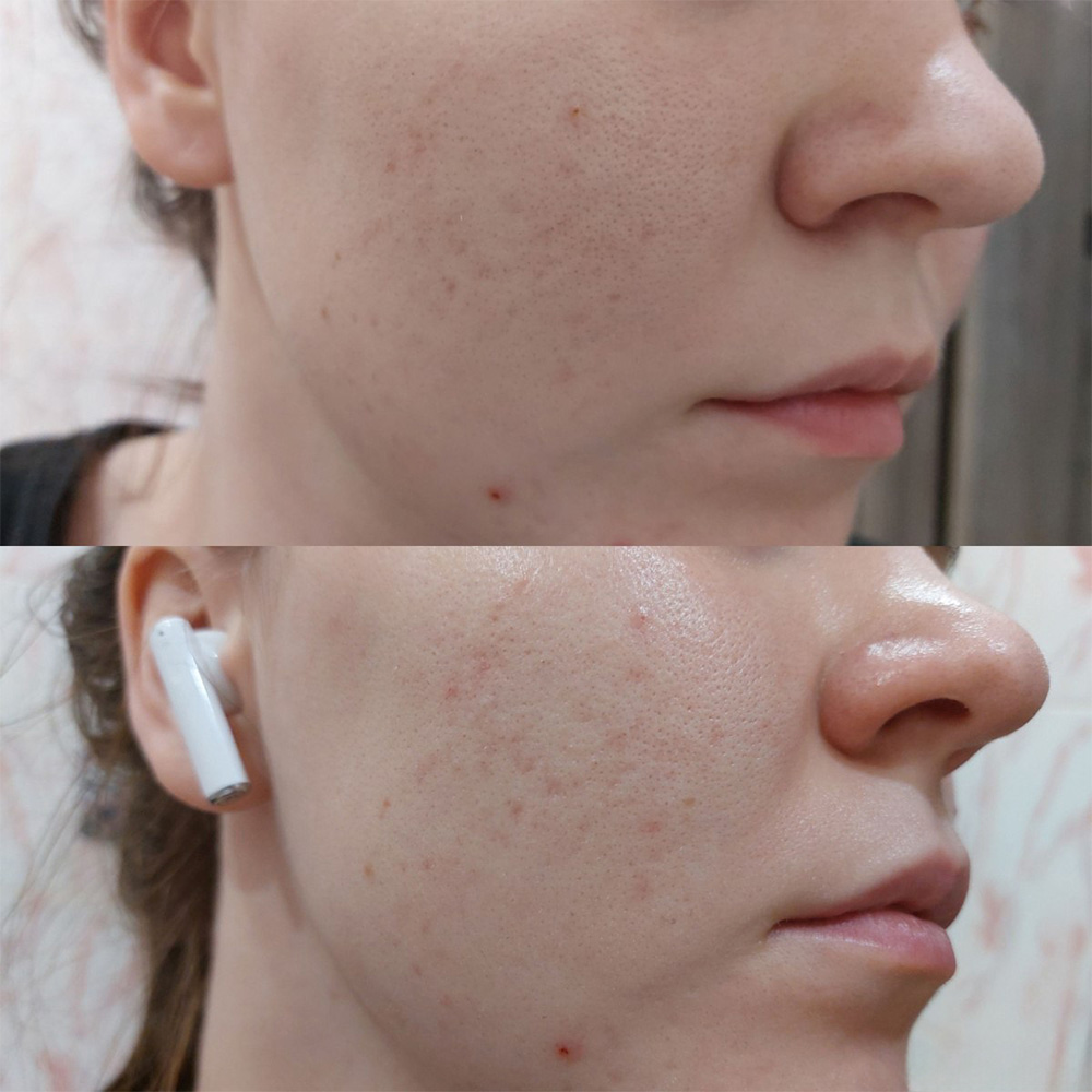 سرم-روشن-کننده-و-کنترل-منافذ-تیام-TIAM-Pore-Minimizing-21-Serum-6