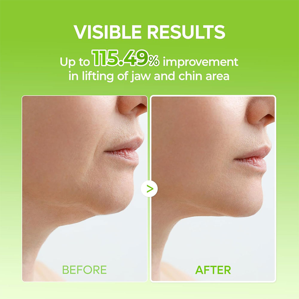 پک-ماسک-لیفت-و-خنک-کننده-فک-و-غبغب-دکتر-ملاکسین-Dr.Melaxin-Cactox-Cooling-V-UP-Mask-Set-4